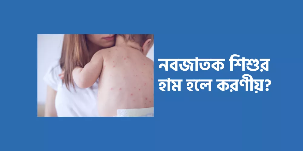 Baby measles1