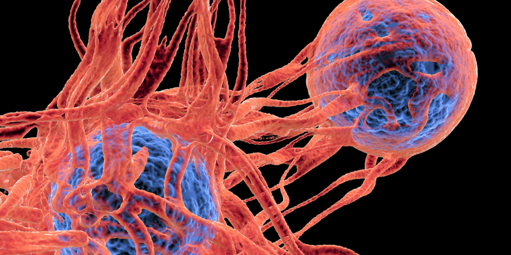 Blood cancer3