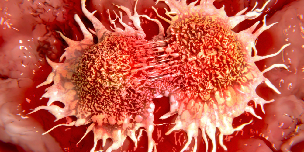 Blood cancer4
