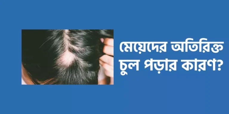 Excessive hair loss in girls