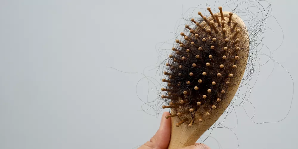 Excessive hair loss in girls2