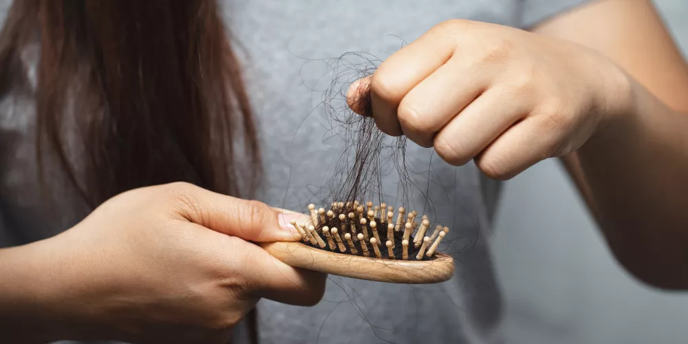 Excessive hair loss in girls4
