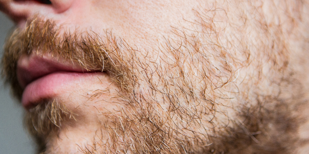 Facial hair3