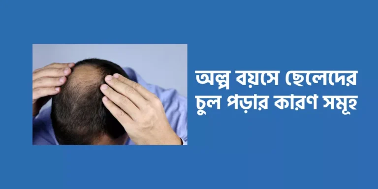 Hair loss1