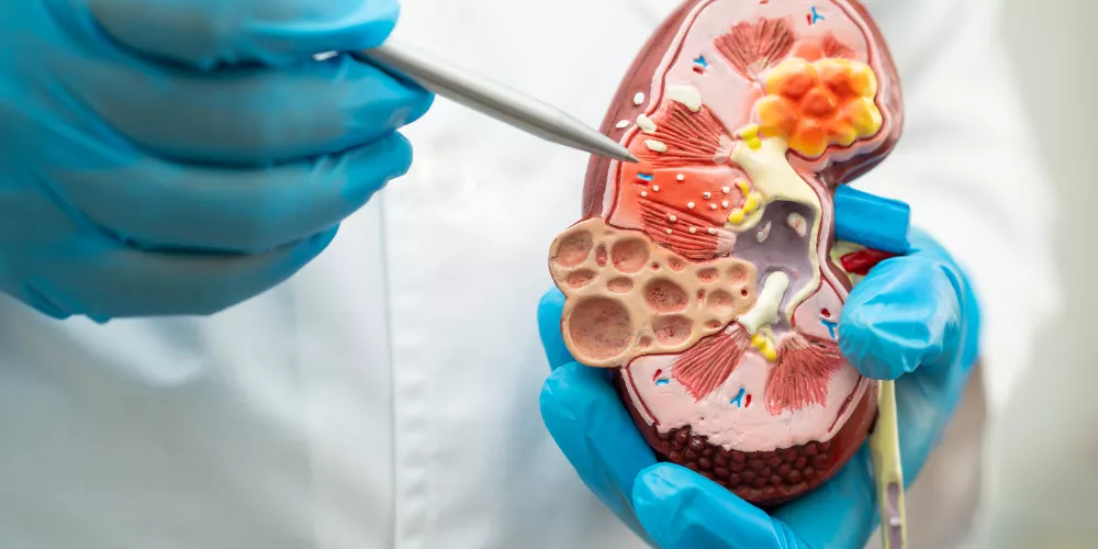 Kidney2