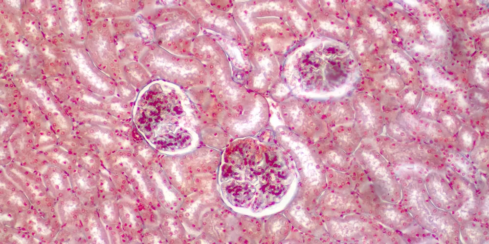Kidney3