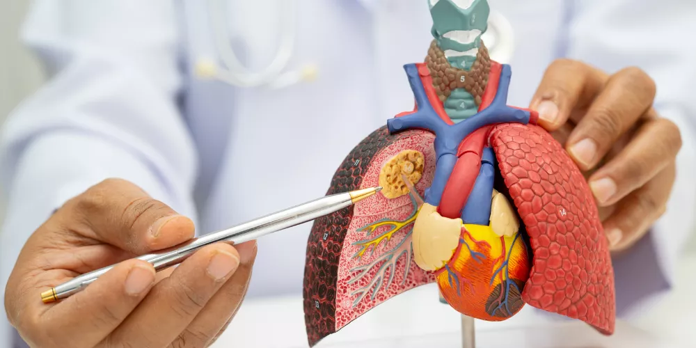 Pneumonia3