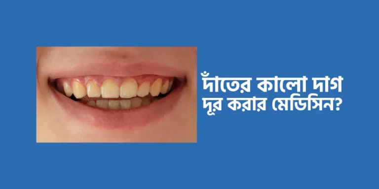 Teeth1