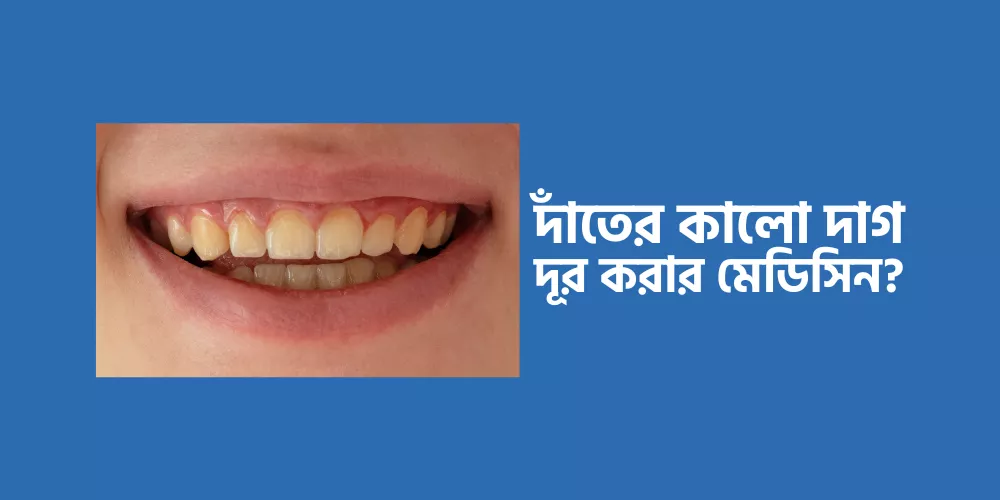 Teeth1