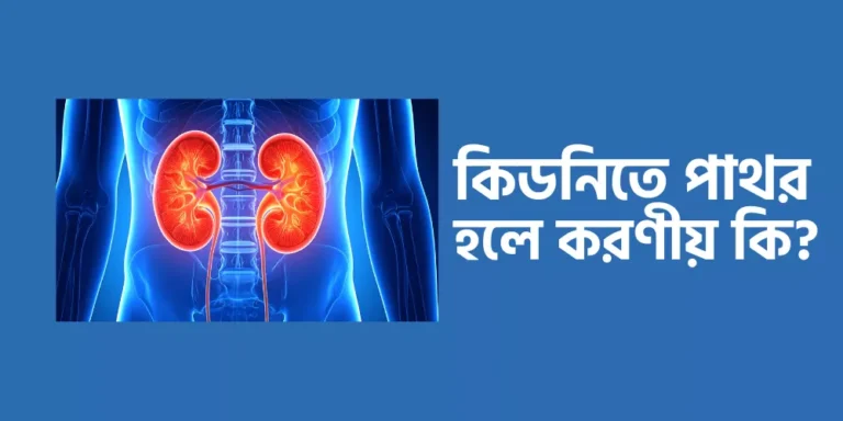 Kidney stones1