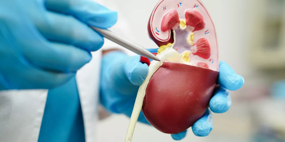 Kidney stones2